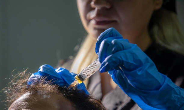 Greffe de Cheveux Naturelle pour Femmes à Paris