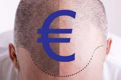 tarif greffe cheveux euro - Tarifs