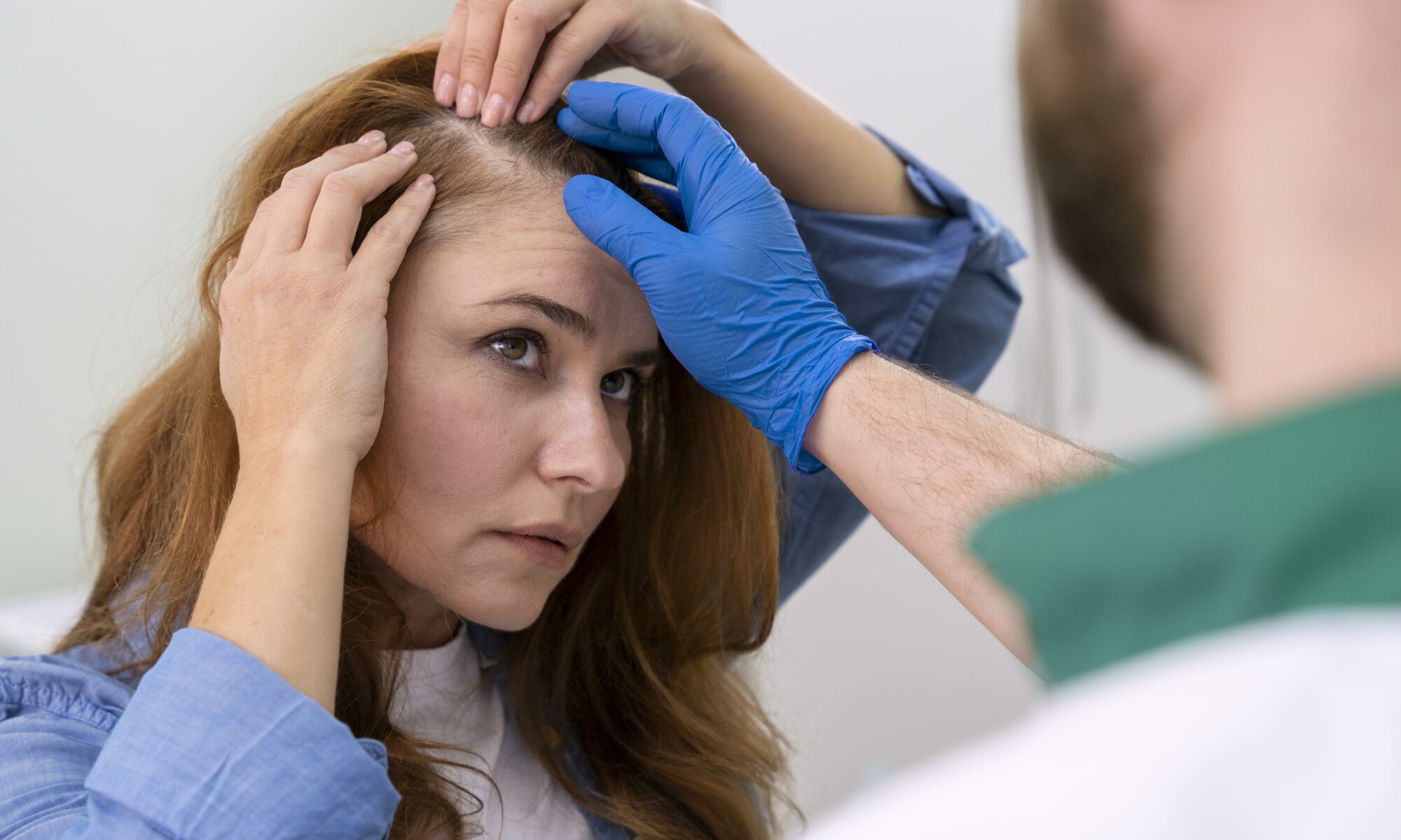 greffe de cheveux après 1 mois